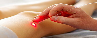 Ultrasound Guided Sclerotherapy