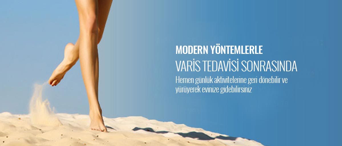 varis tedavisi, modern varis tedavisi