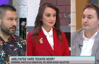 Ameliyatsız Varis Tedavileri