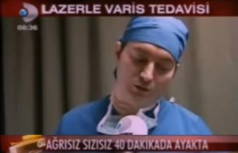 Lazerle Varis Tedavisi